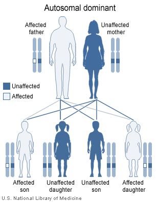 Larsen syndrome - wikidoc