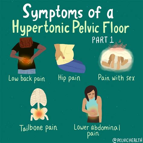 Internal Pelvic Floor Therapy At Home Los Angeles | Viewfloor.co