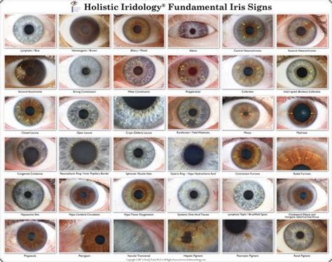 Pin on iridology