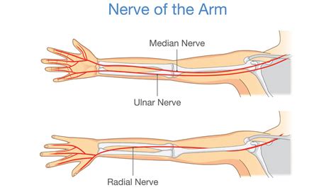 Radial Tunnel Syndrome: Causes, Symptoms, and Treatment