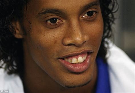 Ronaldinho has goofy teeth fixed in operation - WATCH VIDEO | Daily ...