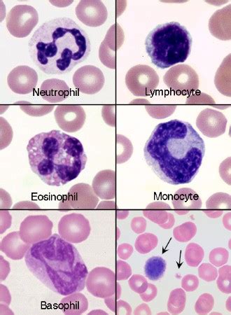 WBC Archives | eClinpath