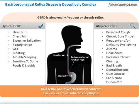 GERD Symptoms: Signs of Acid Reflux Disease - GERDHelp.com