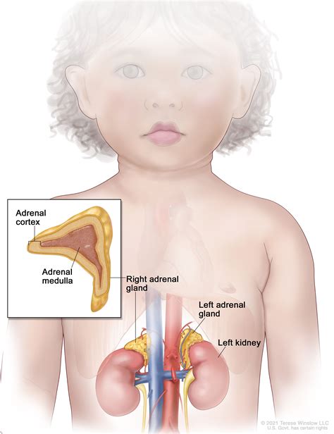 Childhood Adrenocortical Carcinoma Treatment - NCI