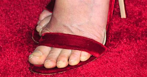 26 Ugly Celebrity Feet: Nasty Corns and Hammer Toes