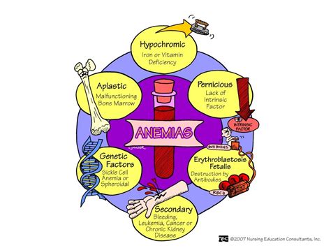 Anemias Nursing School Studying, Nursing School Notes, Nursing Study, Nursing Schools, Nursing ...