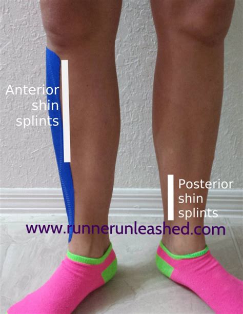 Anterior and posterior shin splints. Causes symptoms and advice and stretches to help treat or ...