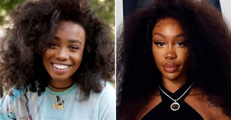 SZA Plastic Surgery: Singer Transformation | PlasticSurgeryInsights.com