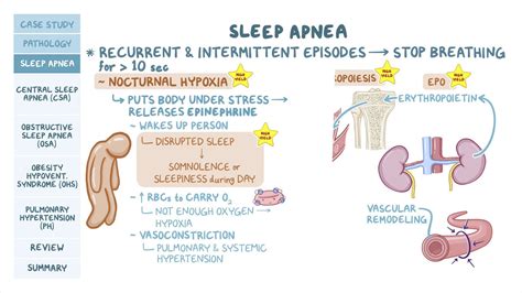 Apnea, hypoventilation and pulmonary hypertension: Pathology review - Osmosis