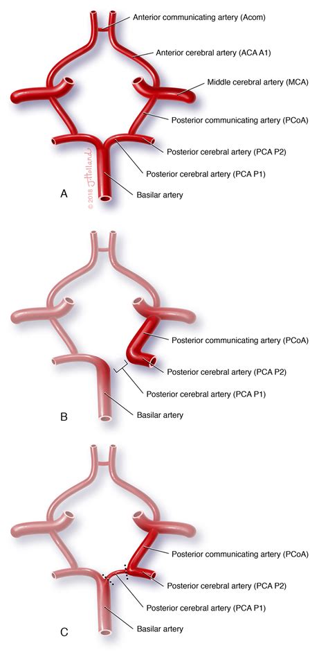 Variant Meaning