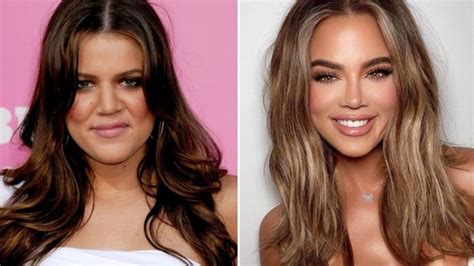 Reason Behind Khloe Kardashian Transformation? Does Khloe Had Plastic ...