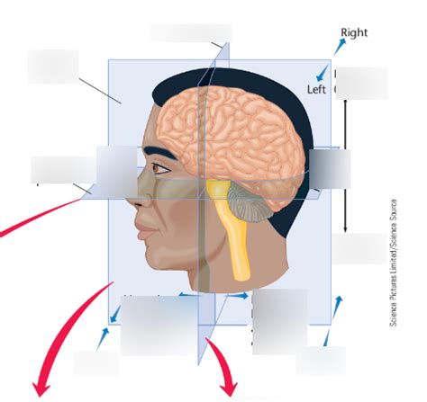 Sheep saigitall brain Diagram | Quizlet