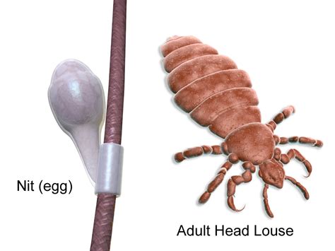 Human Head Lice: What You Need To Know - Massey Services, Inc.