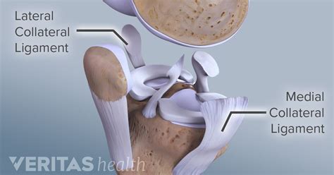 Symptoms of LCL (Lateral Collateral Ligament) Tears