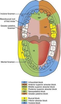 Local anesthesia | Dental, Dentistry, Dental hygiene