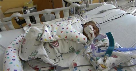 Hospitals see rise in babies with respiratory illness RSV - CBS News