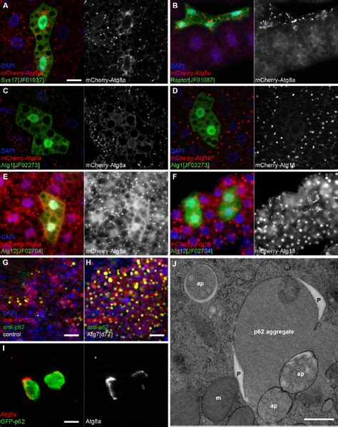 Specific markers of autophagy. (A) The most popular markers of ...