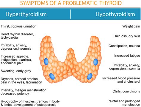 thyroidism-insert-final | Sunrise Functional Medicine