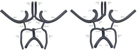 2: Variations in the Circle of Willis | Download Scientific Diagram