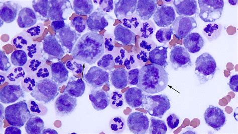 Equine peritoneal fluid | eClinpath