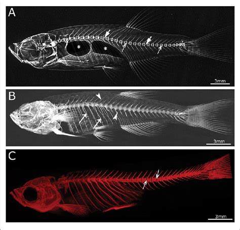 | Imaging techniques in zebrafish. (A) Lateral x-ray image of a wild... | Download Scientific ...