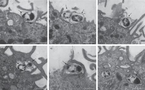 Phagocytosis Microscope