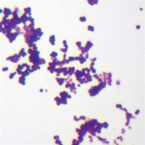 Mixed Gram-Positive & Gram-Negative Coccus, W.M. Gram Stain Microscope ...