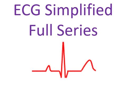 EKG Vs ECG What's The Difference Between ECG And EKG?, 42% OFF