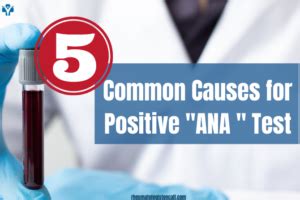 Positive ANA -Know Common 5 causes for a positive ANA Test