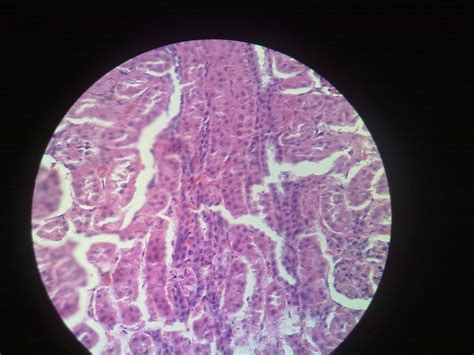 Kidney Histology – howMed