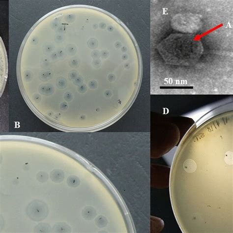 The presence of bacteriophage in the studied sample. A, B, and C:... | Download Scientific Diagram