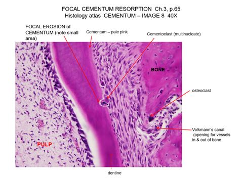 Cementum Histology