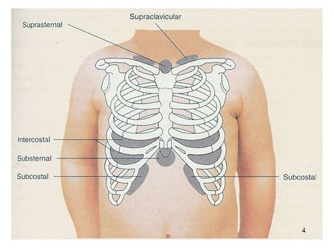 nasal flaring + Suprasternal retractions - DarmanX Academy