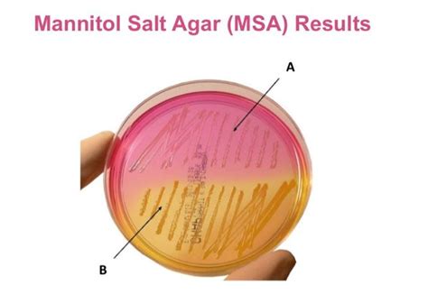 Solved 2. The growth of bacteria on section A of the MSA | Chegg.com