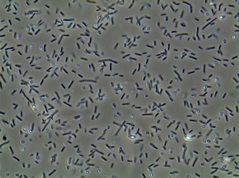 Urine Sediment of the Month: Microorganisms - Renal Fellow Network