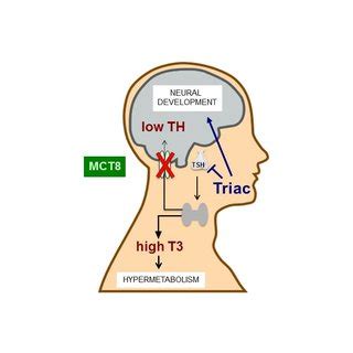 Components leading to heart failure in hypothyroidism. | Download Scientific Diagram