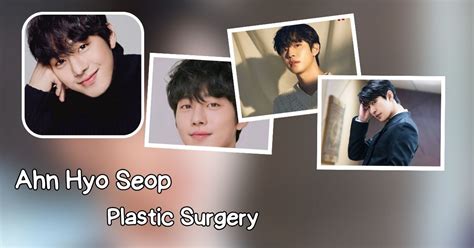 Ahn Hyo Seop Plastic Surgery- The Rumors And The Facts