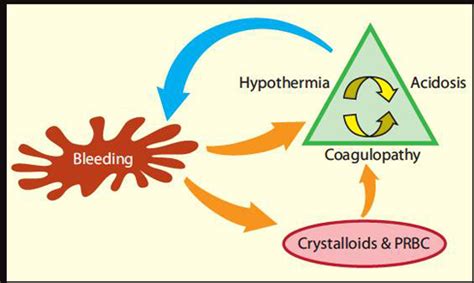 Trauma’s Lethal Triad of Hypothermia, Acidosis & Coagulopathy Create a ...