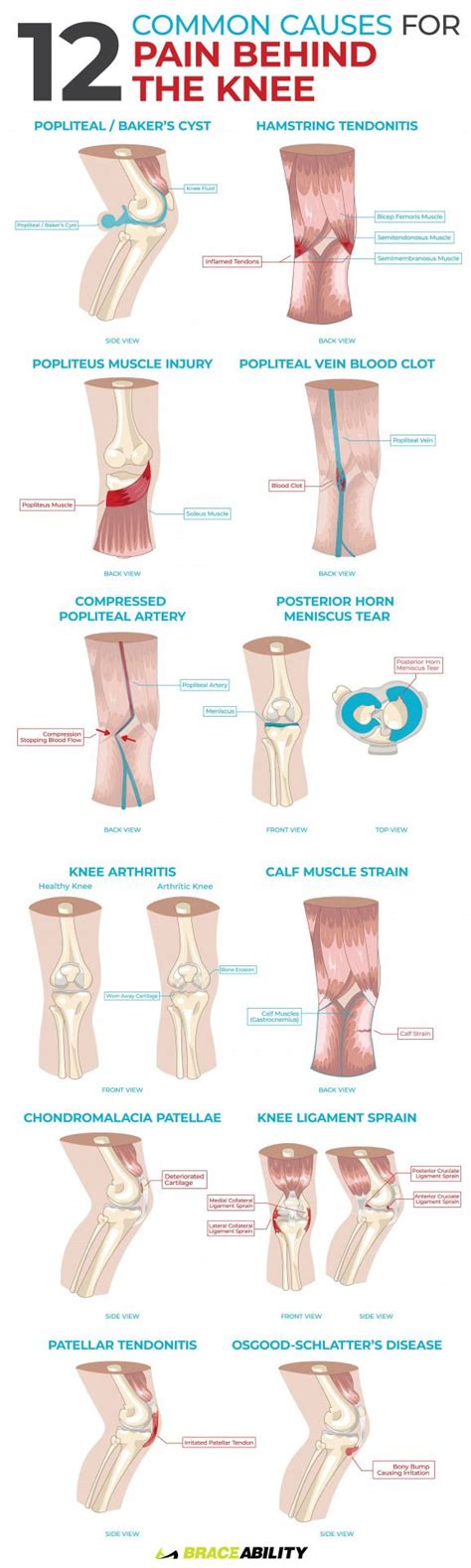 Pin on Joint Pain relief