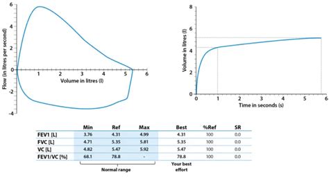 Spirometry: Procedure and All You Must Know | Healthtian