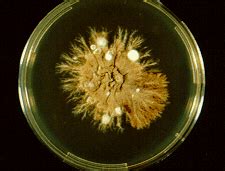 MedBankers.: PEI SHAN - Fungal pathogens 2nd post