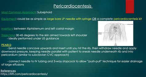 Pericardiocentesis Needle