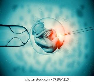 3d Rendering Artificial Insemination Invitro Fertilization Stock ...