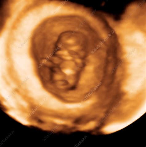 Foetus in the womb 3D ultrasound - Stock Image - C001/2087 - Science Photo Library