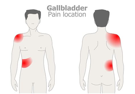 Gallbladder Pain Attack Location Stones Cancer Polyps Tumors Blockages ...