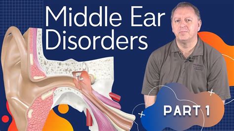 Ear Disorders Pt1: Middle Ear Infection Symptoms & Otitis Media Causes | Ruptured Eardrum ...