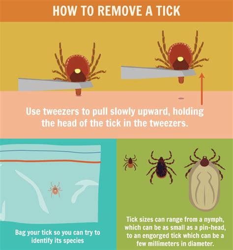 Here's What You Need To Know About Ticks | Ticks, Tick removal, Tick bite