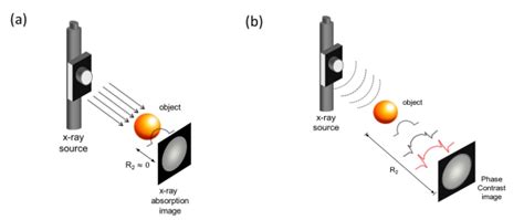 Phase-contrast X-ray imaging techniques 相位對比X光成像技術