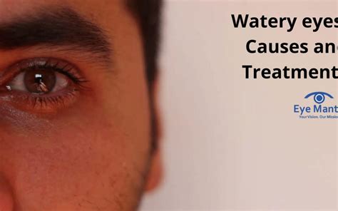 Watery eyes: Causes and Treatments | EyeMantra Foundation