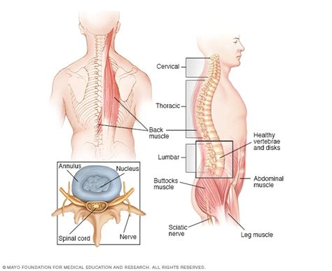 Bone Cancer Pain In Lower Back - CancerWalls